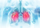 Koronavirüs Sonrası Akciğerlerinizi Yenileyecek 7 Önemli Egzersiz